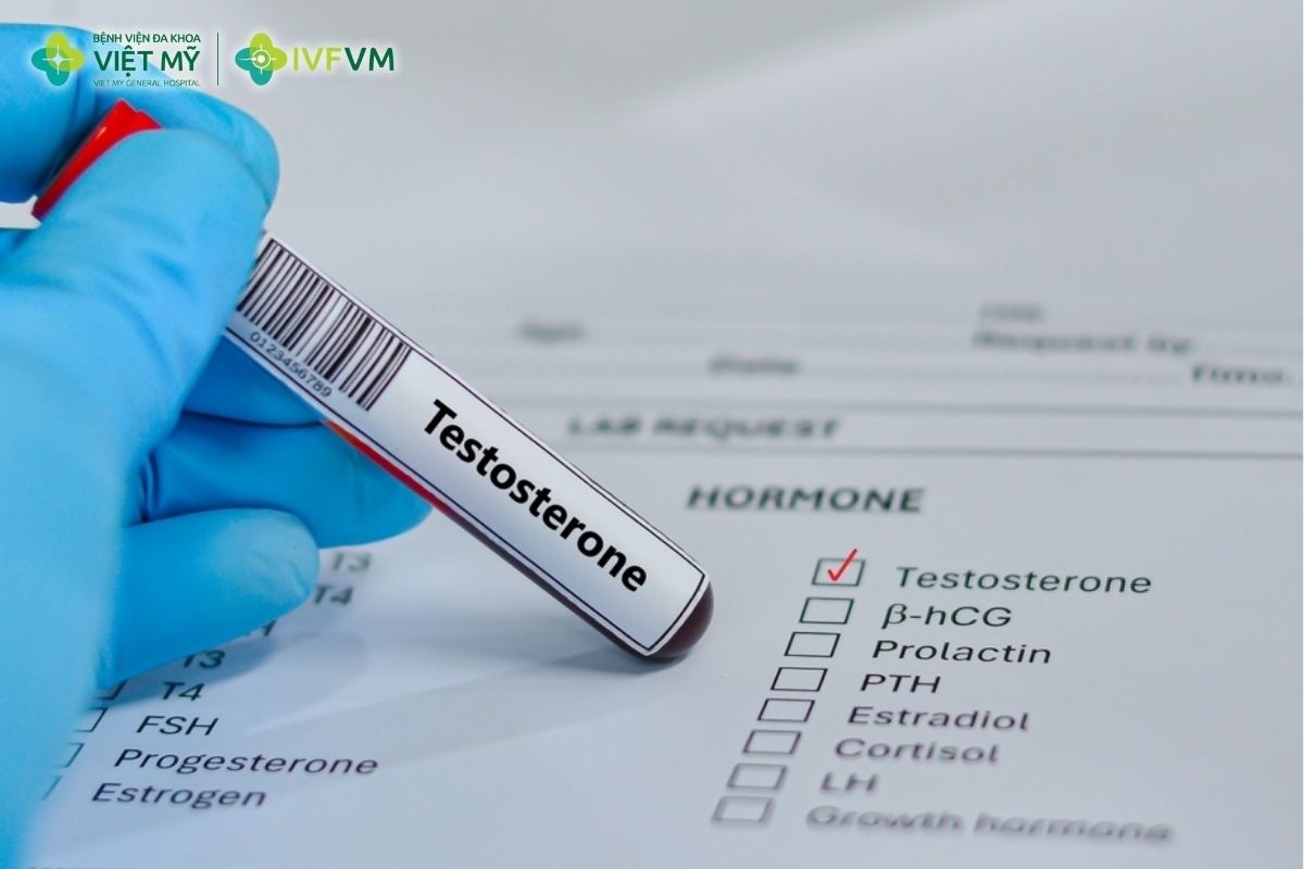 Xét nghiệm Testosterone giúp đánh giá nội tiết nam và khả năng sinh tinh