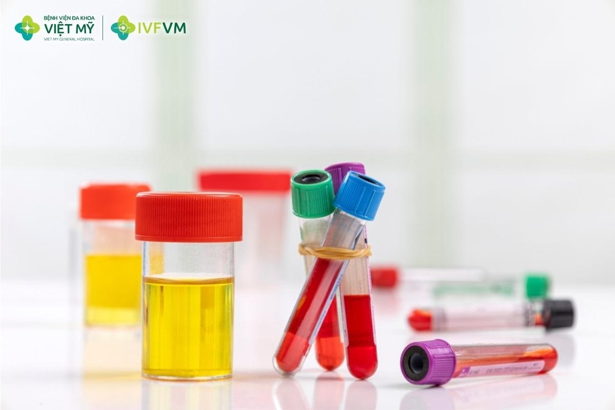 Xét nghiệm máu và nước tiểu đánh giá sức khỏe tổng quát của người vợ trước khi thực hiện IVF