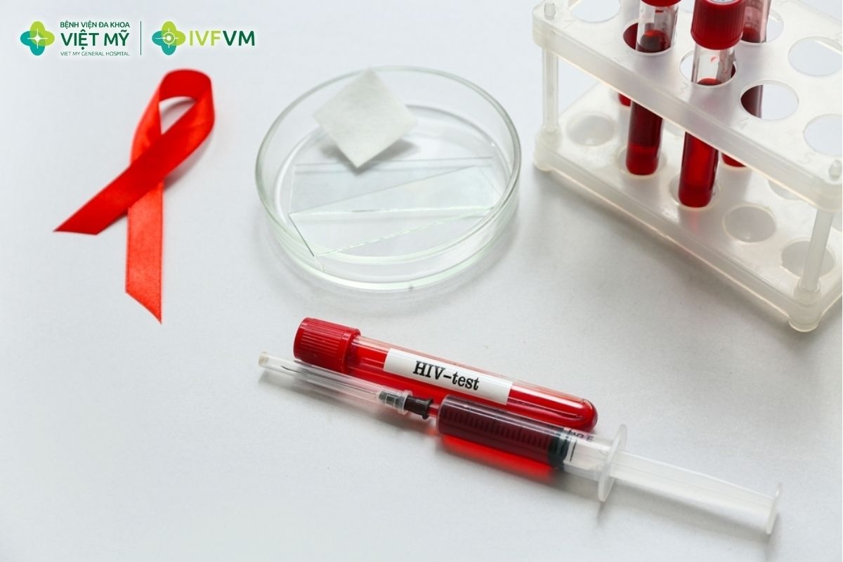 Xét nghiệm HIV giúp sàng lọc nhiễm HIV trước khi thực hiện IVF