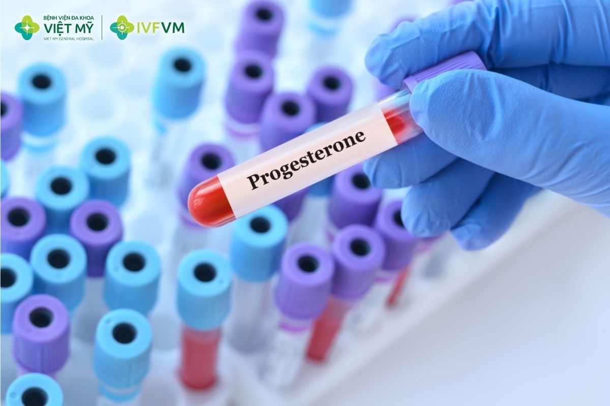 Theo dõi chỉ số progesterone trong IVF giúp bác sĩ đánh giá sự chuẩn bị của niêm mạc tử cung và lựa chọn thời điểm chuyển phôi phù hợp