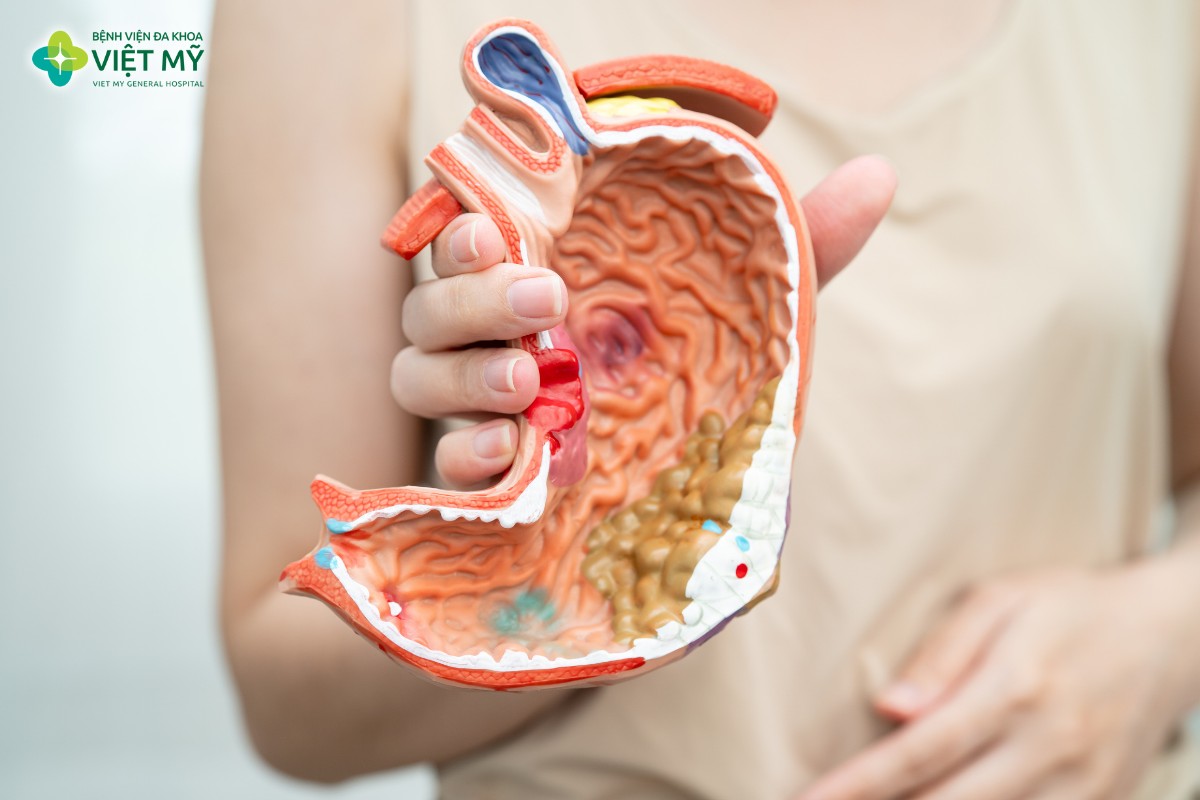 Nội soi tiêu hóa thường được chia thành nội soi tiêu hóa trên và nội soi tiêu hóa dưới